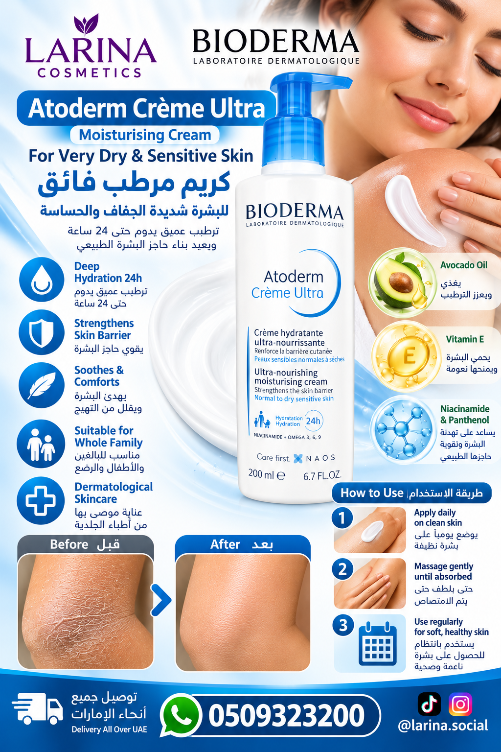 Bioderma Atoderm Crème Ultra – Ultra-Moisturizing Cream for Dry & Sensitive Skin 200ml